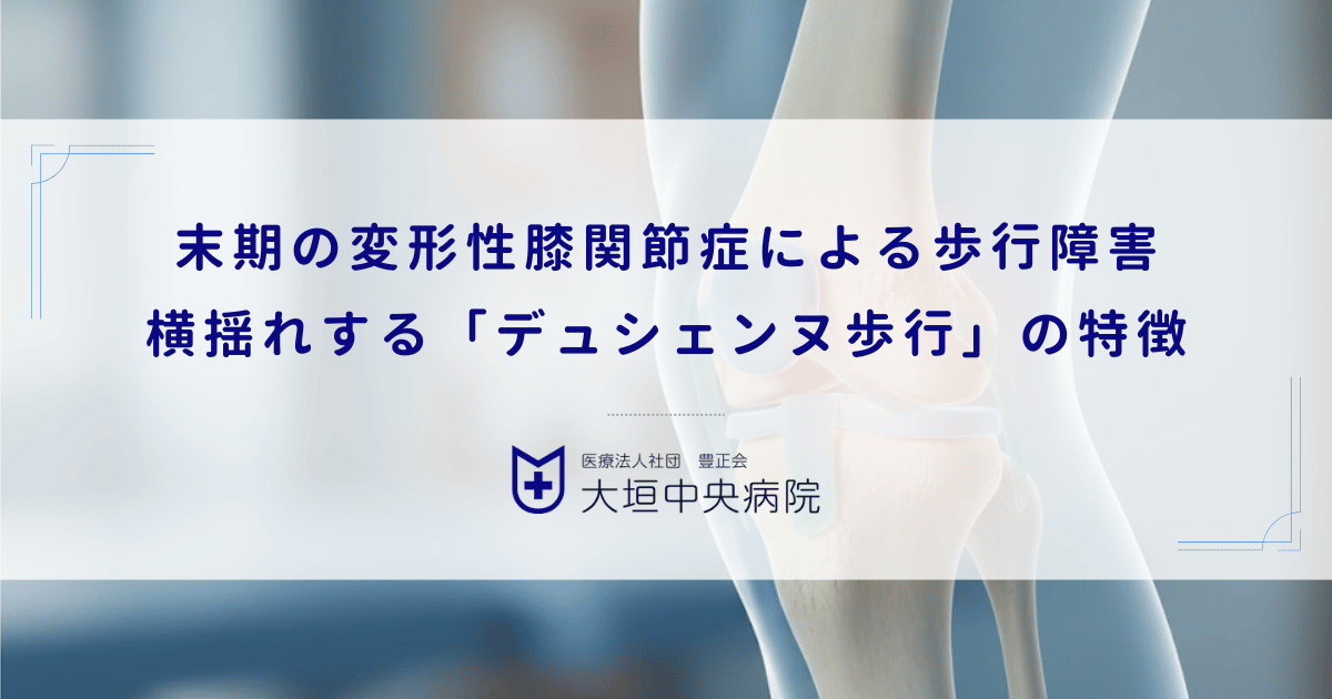 末期の変形性膝関節症による歩行障害｜横揺れする「デュシェンヌ歩行」の特徴