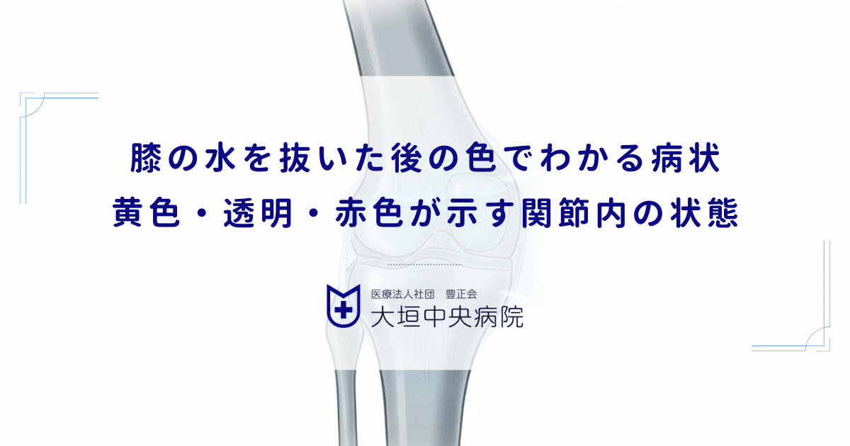 膝の水を抜いた後の色でわかる病状|黄色・透明・赤色が示す関節内の状態