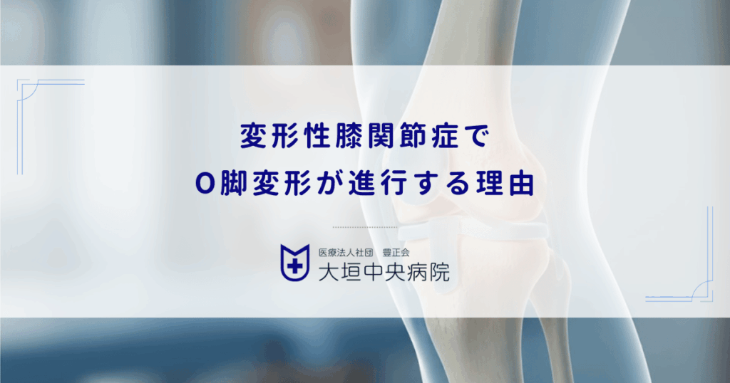 変形性膝関節症でO脚変形が進行する理由｜見た目の変化と脚長差の影響