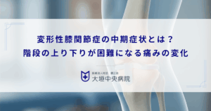 変形性膝関節症の中期症状とは？階段の上り下りが困難になる痛みの変化