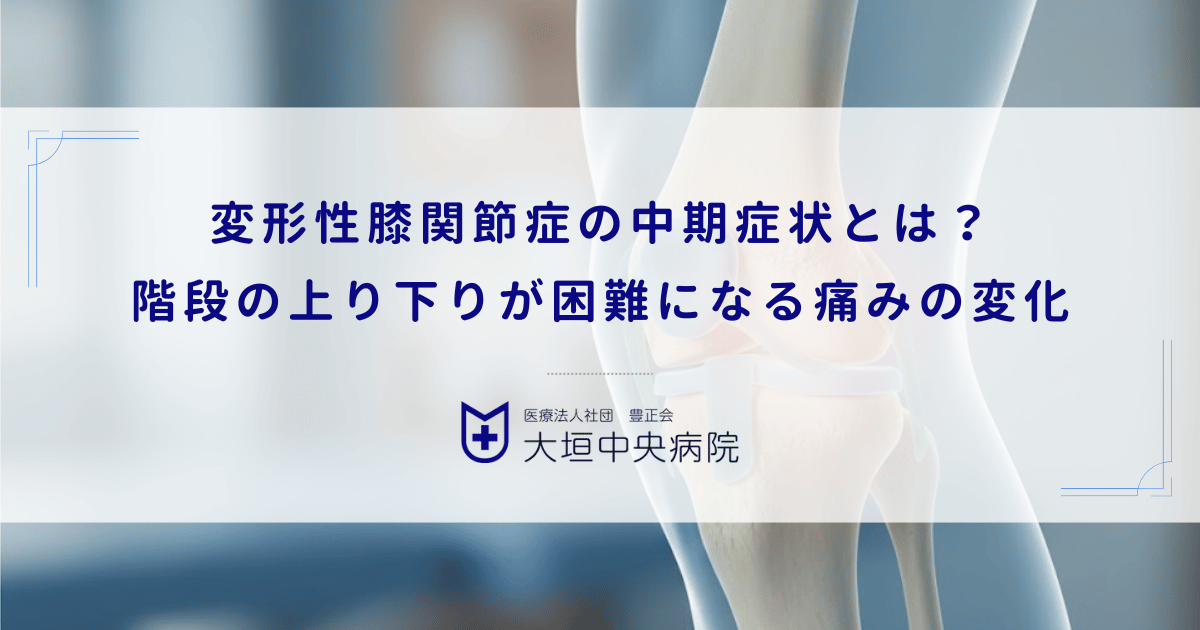 変形性膝関節症の中期症状とは？階段の上り下りが困難になる痛みの変化