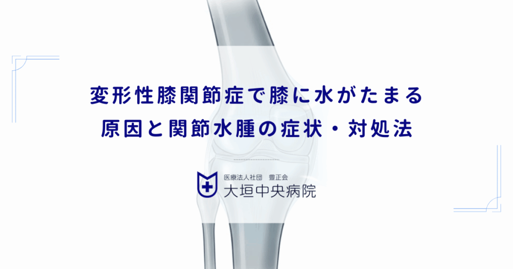 変形性膝関節症で膝に水がたまる原因と関節水腫の症状・対処法