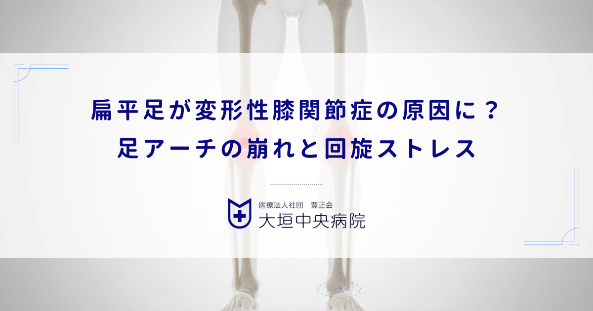 扁平足(へんぺいそく)が変形性膝関節症の原因に?足アーチの崩れと回旋ストレス