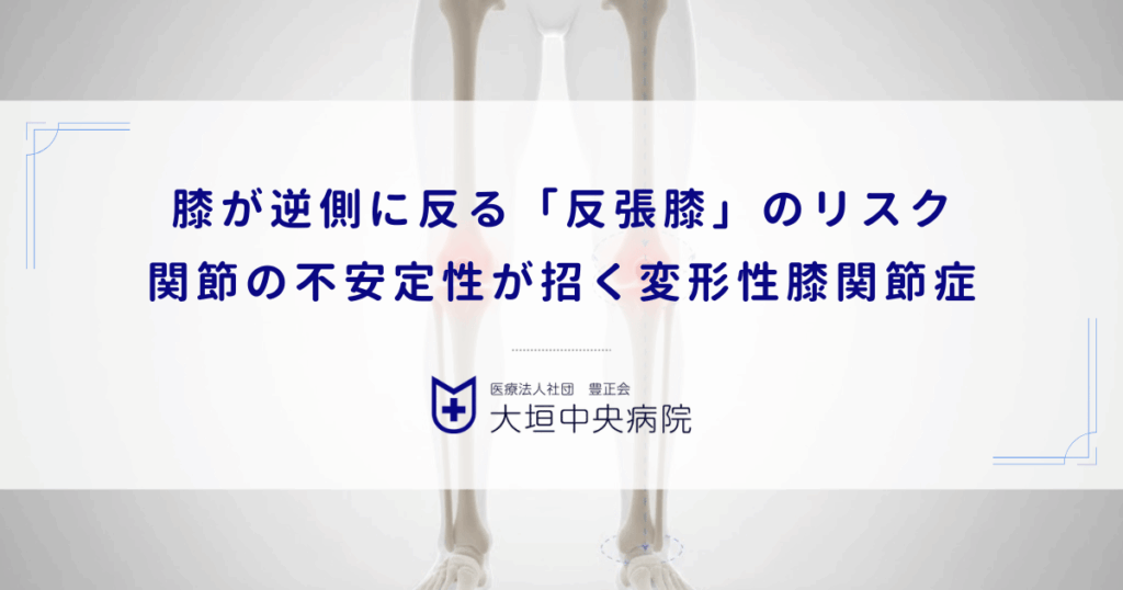 膝が逆側に反る「反張膝」のリスク｜関節の不安定性が招く変形性膝関節症