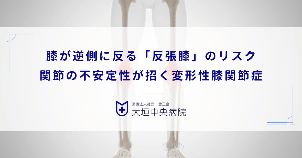 膝が逆側に反る「反張膝」のリスク｜関節の不安定性が招く変形性膝関節症