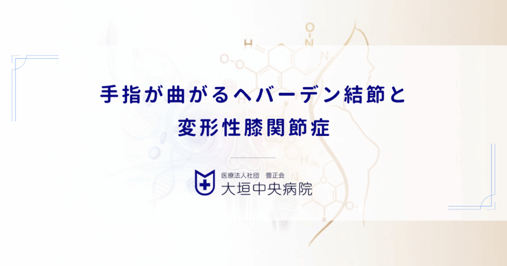 手指が曲がるヘバーデン結節と変形性膝関節症｜女性に多い全身性変形性関節症の関連