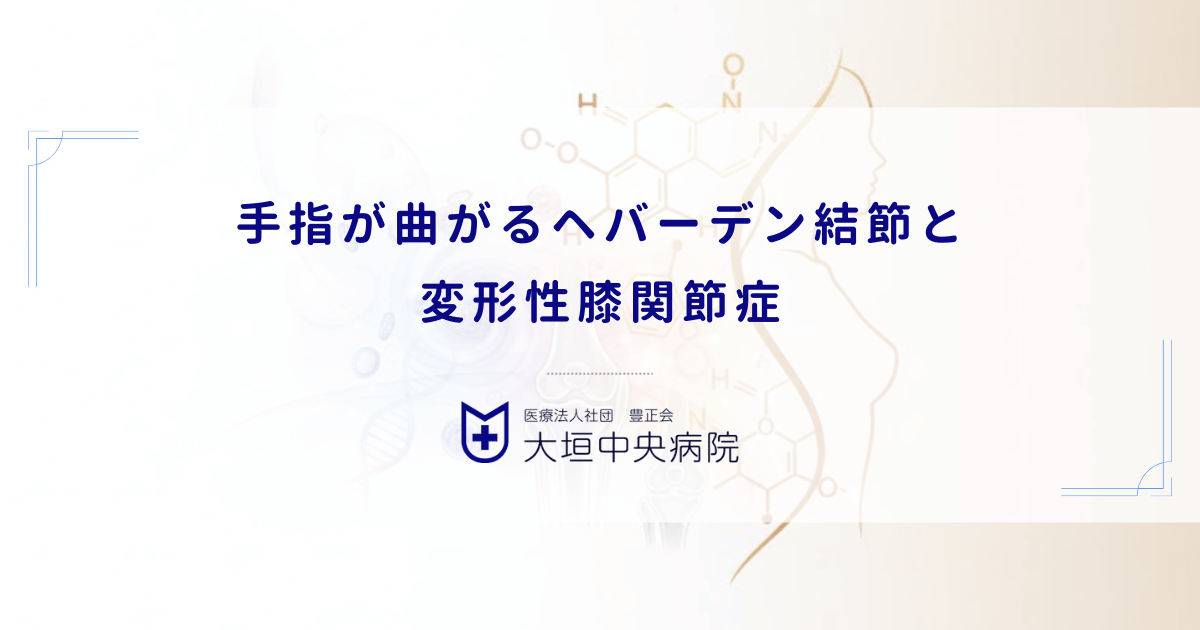 手指が曲がるヘバーデン結節と変形性膝関節症|女性に多い全身性変形性関節症の関連