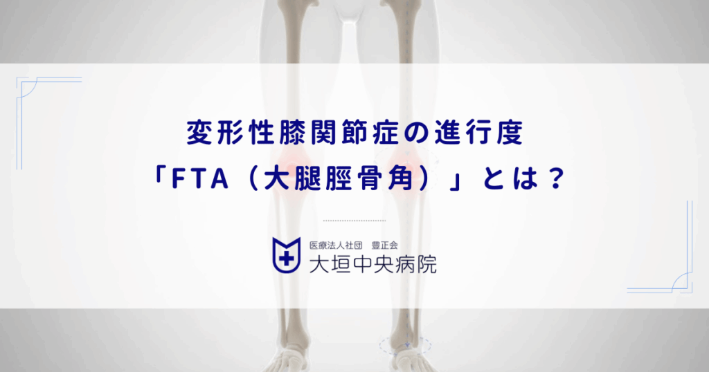 変形性膝関節症の進行度「FTA（大腿脛骨角）」とは？O脚の角度と重症度チェック