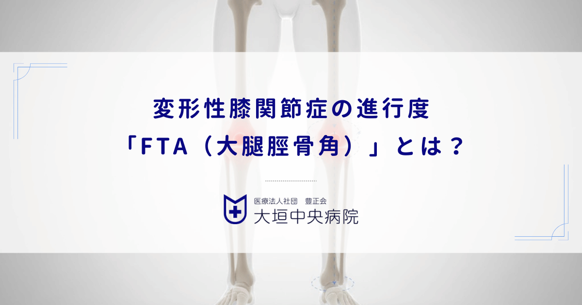 変形性膝関節症の進行度「FTA（大腿脛骨角）」とは？O脚の角度と重症度チェック