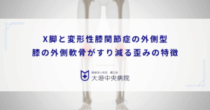 X脚（外反膝）と変形性膝関節症の外側型｜膝の外側軟骨がすり減る歪みの特徴