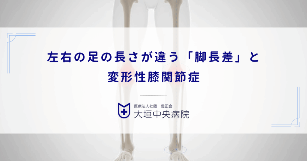 左右の足の長さが違う「脚長差」と変形性膝関節症｜片側だけ軟骨が減る原因