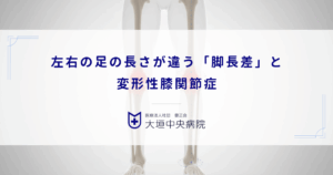 左右の足の長さが違う「脚長差」と変形性膝関節症｜片側だけ軟骨が減る原因