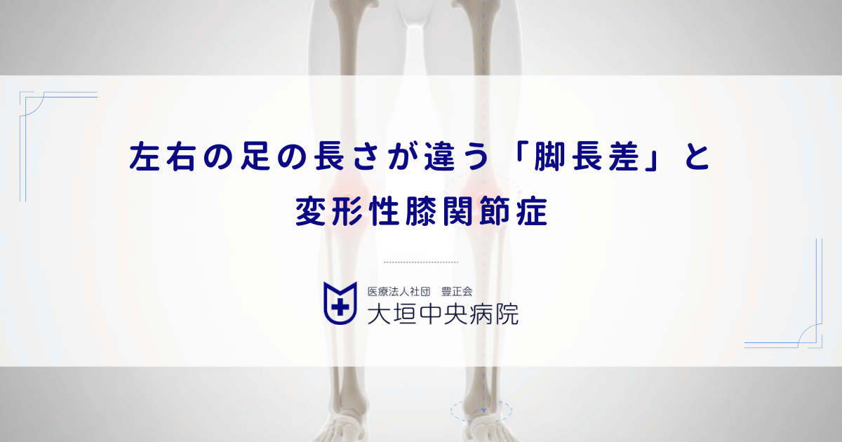 左右の足の長さが違う「脚長差」と変形性膝関節症｜片側だけ軟骨が減る原因