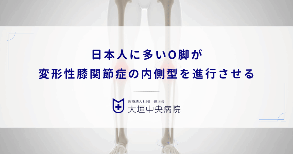 日本人に多いO脚（内反膝）が変形性膝関節症の内側型を進行させる力学的理由