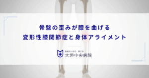 骨盤の歪み（後傾）が膝を曲げる｜変形性膝関節症と身体アライメントの連鎖