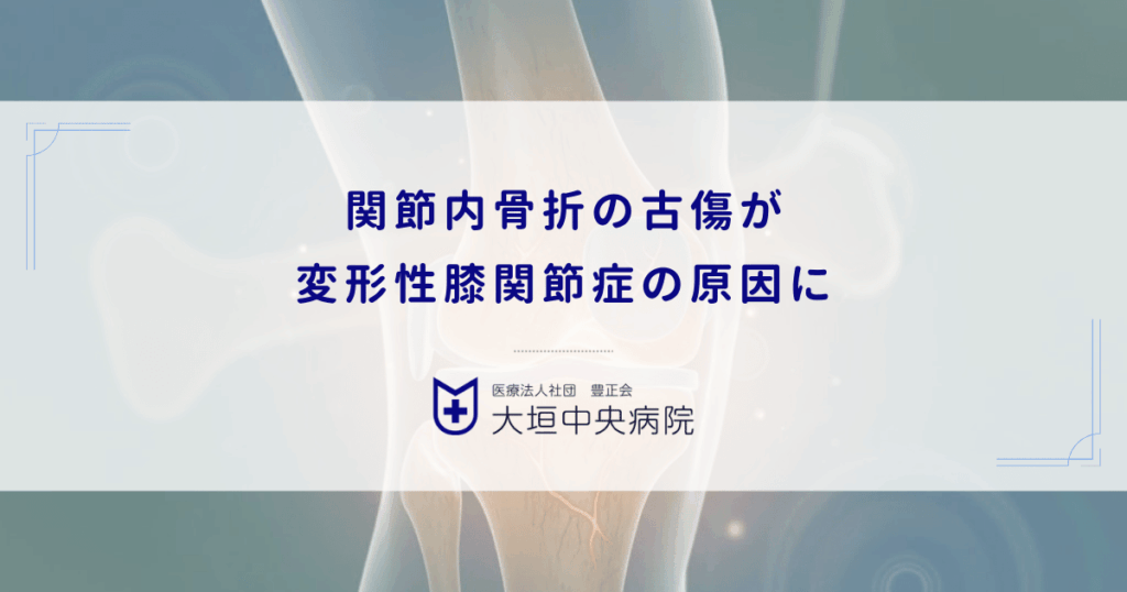 関節内骨折の古傷が変形性膝関節症の原因に｜不整な治癒が引き起こす長期的な痛み