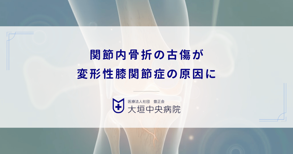 関節内骨折の古傷が変形性膝関節症の原因に|不整な治癒が引き起こす長期的な痛み