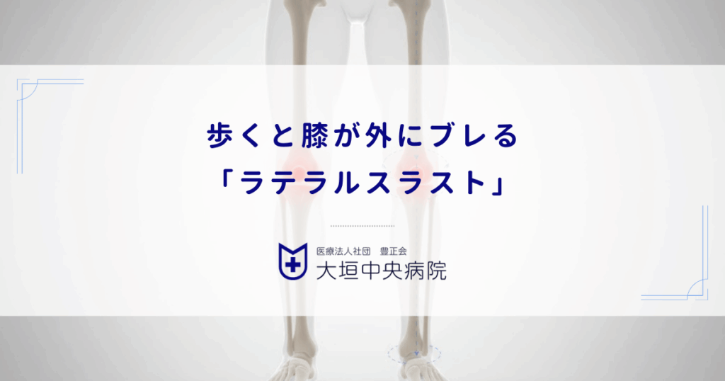 歩くと膝が外にブレる「ラテラルスラスト」｜変形性膝関節症を急速に悪化させる動作
