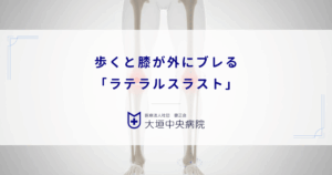 歩くと膝が外にブレる「ラテラルスラスト」｜変形性膝関節症を急速に悪化させる動作