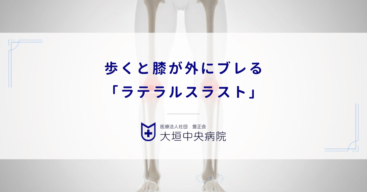 歩くと膝が外にブレる「ラテラルスラスト」|変形性膝関節症を急速に悪化させる動作