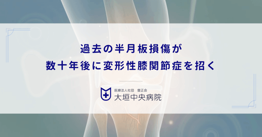 過去の半月板損傷が数十年後に変形性膝関節症を招く｜クッション喪失の代償