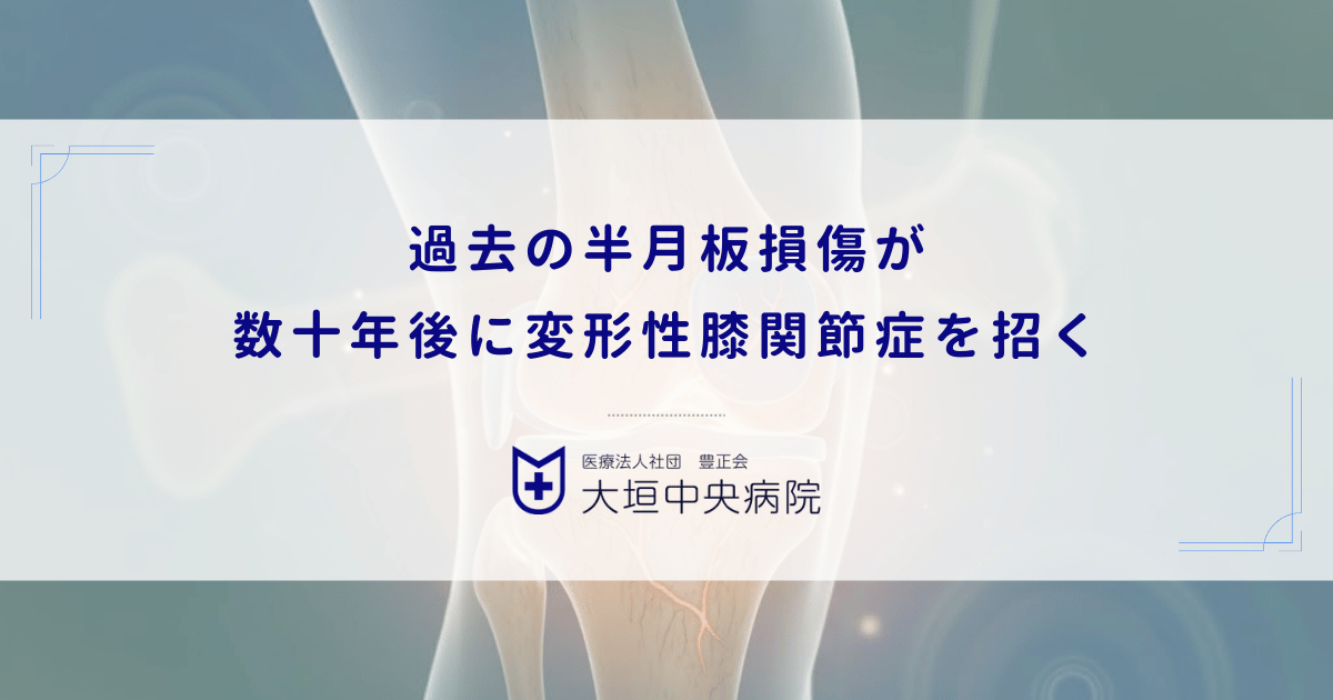 過去の半月板損傷が数十年後に変形性膝関節症を招く｜クッション喪失の代償