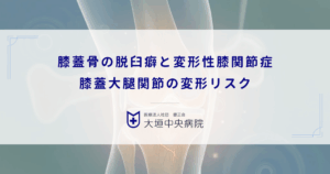 膝蓋骨（お皿）の脱臼癖と変形性膝関節症｜膝蓋大腿関節（PF関節）の変形リスク