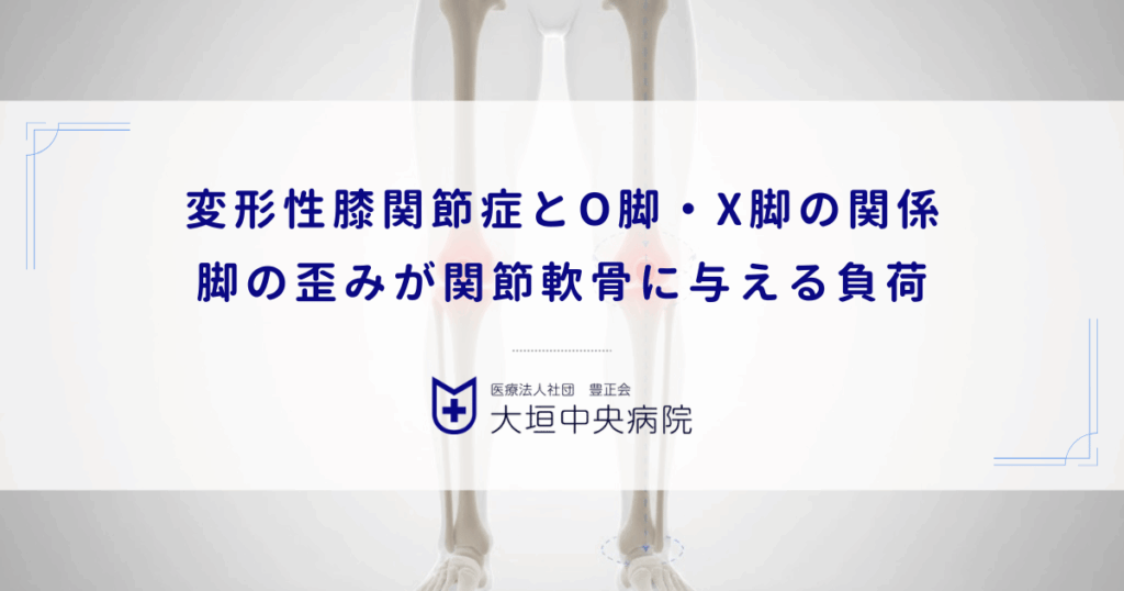 変形性膝関節症とO脚・X脚の関係｜脚の歪みが関節軟骨に与える負荷