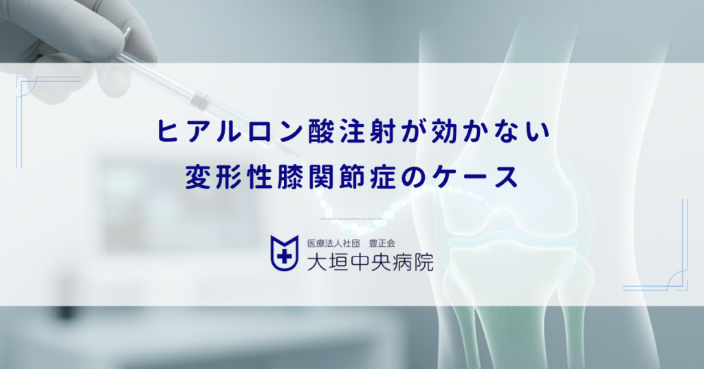 ヒアルロン酸注射が効かない変形性膝関節症のケース｜炎症が強い場合の次なる選択肢