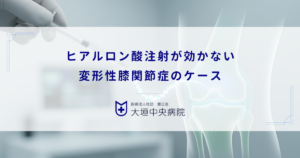 ヒアルロン酸注射が効かない変形性膝関節症のケース｜炎症が強い場合の次なる選択肢