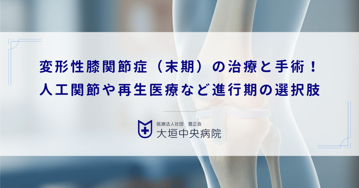 変形性膝関節症（末期）の治療と手術！人工関節や再生医療など進行期の選択肢