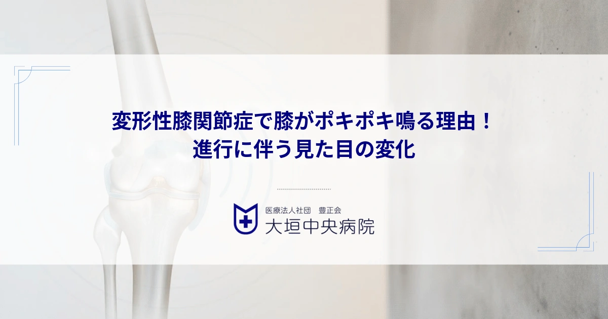 変形性膝関節症で膝がポキポキ鳴る理由！進行に伴うO脚など見た目の変化