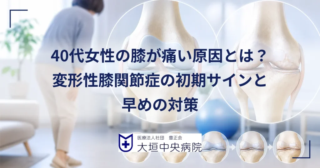 40代女性が膝の痛みにそっと手を添える様子と変形性膝関節症の初期の膝を表した医療イラスト