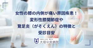 膝の内側を手で押さえて痛みを気にする女性と、変形性膝関節症と鵞足炎の位置を示した膝の内側の医療イラスト