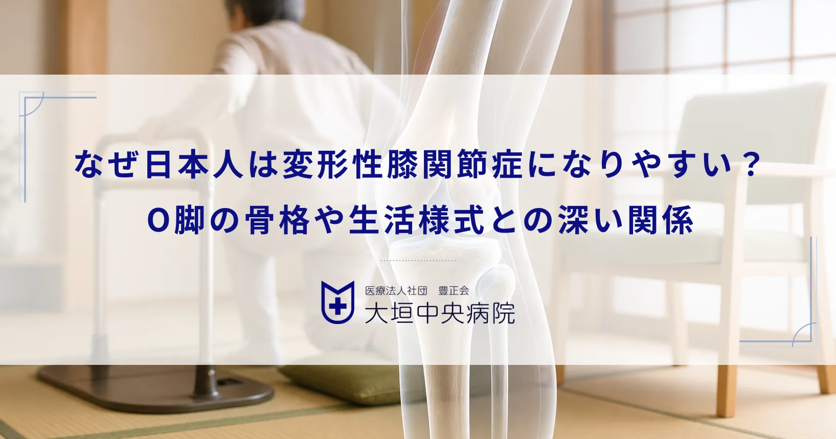 なぜ日本人は変形性膝関節症になりやすい？O脚の骨格や生活様式との深い関係