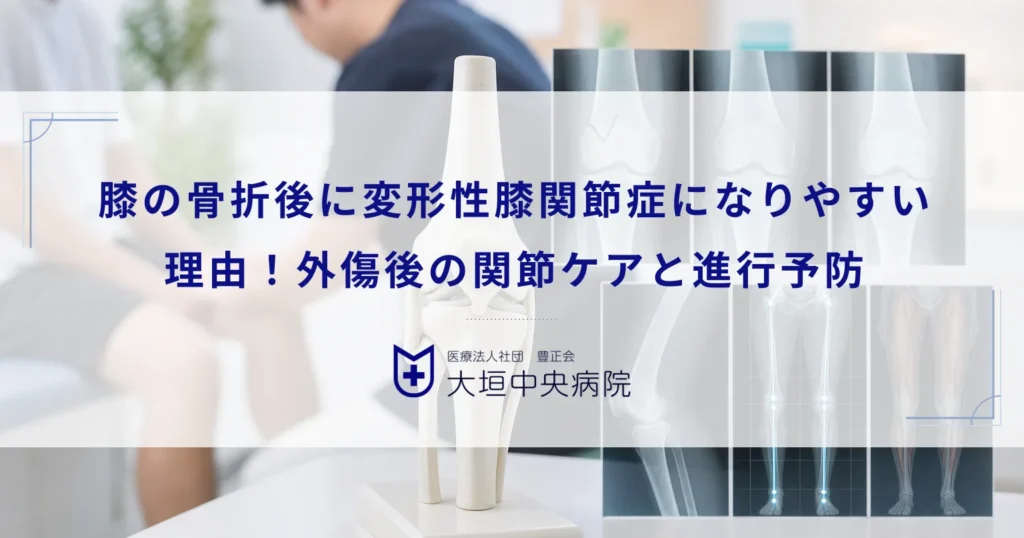 膝の骨折後に変形性膝関節症になりやすい理由！外傷後の関節ケアと進行予防
