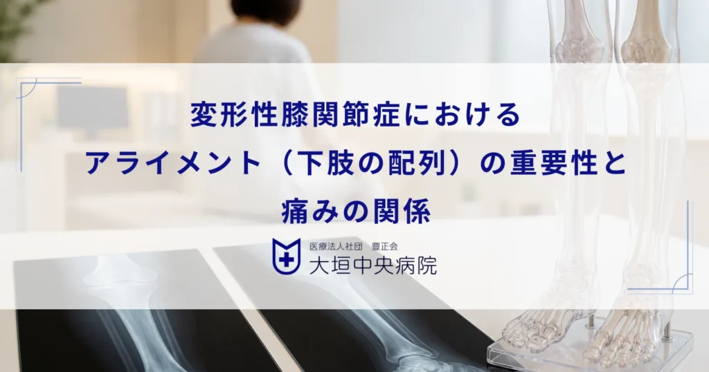 変形性膝関節症におけるアライメント（下肢の配列）の重要性と痛みの関係
