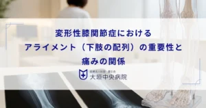 変形性膝関節症におけるアライメント（下肢の配列）の重要性と痛みの関係