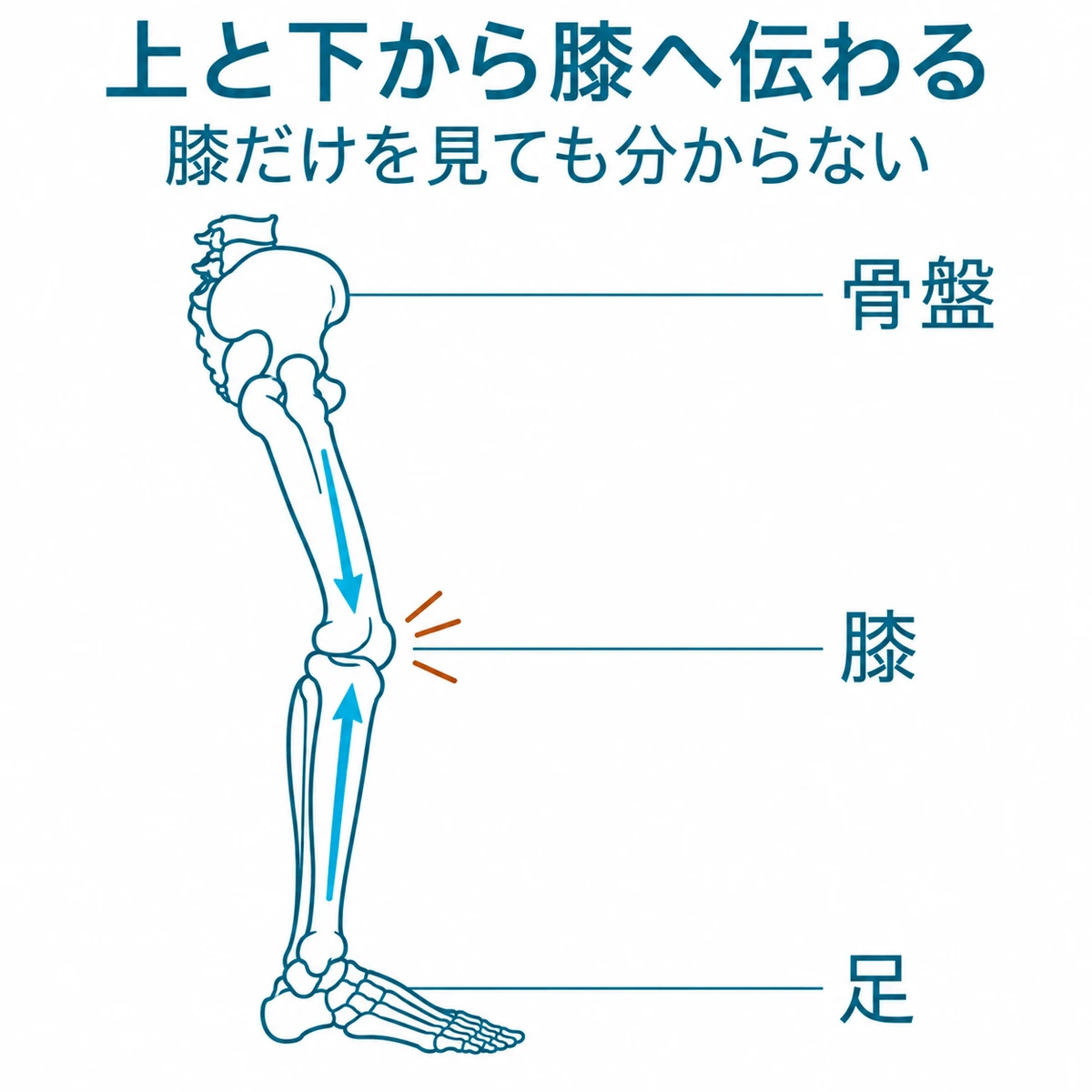 骨盤と足から膝へ歪みが伝わる関係を、脚の骨格と上下の矢印で示した図