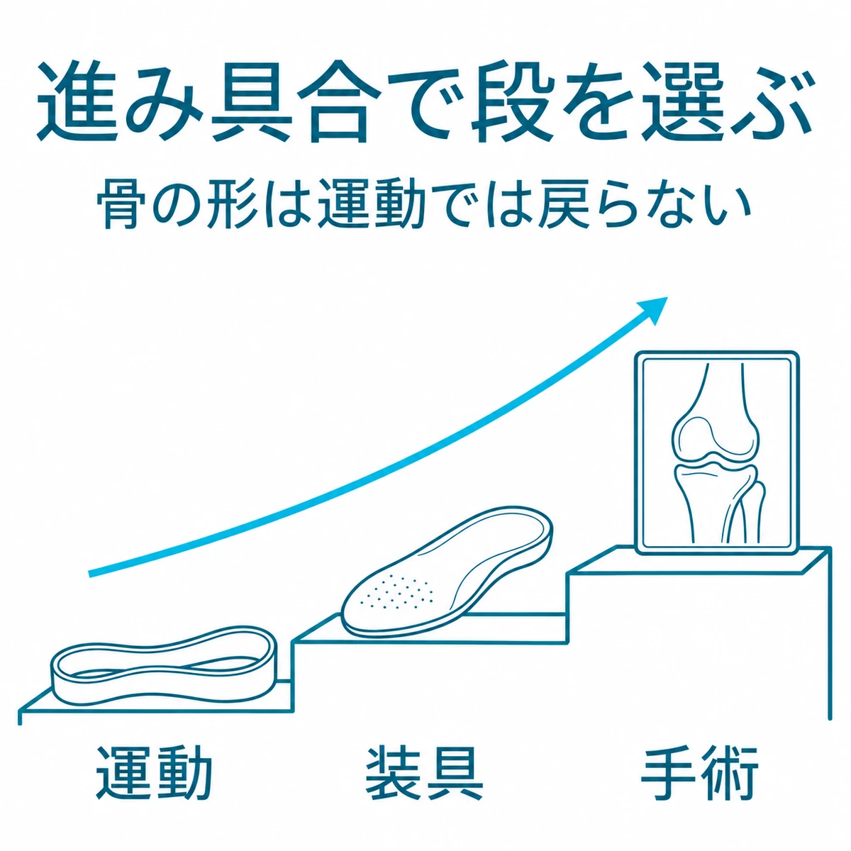 運動、装具、手術という対処の段階を、右上がりの3段の階段で表した図