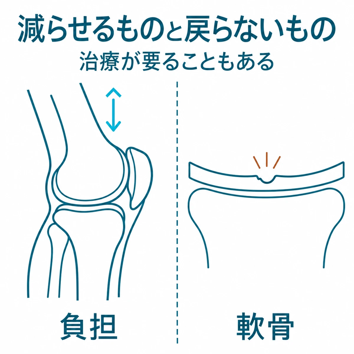 減量で軽くなりうる膝の負担と、元に戻らない軟骨を左右に対比した図