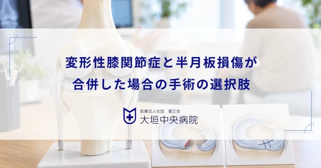 変形性膝関節症と半月板損傷が合併した場合の手術｜関節鏡などの治療の選択肢