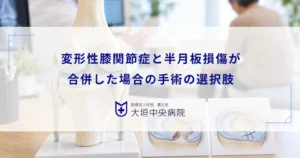 変形性膝関節症と半月板損傷が合併した場合の手術｜関節鏡などの治療の選択肢