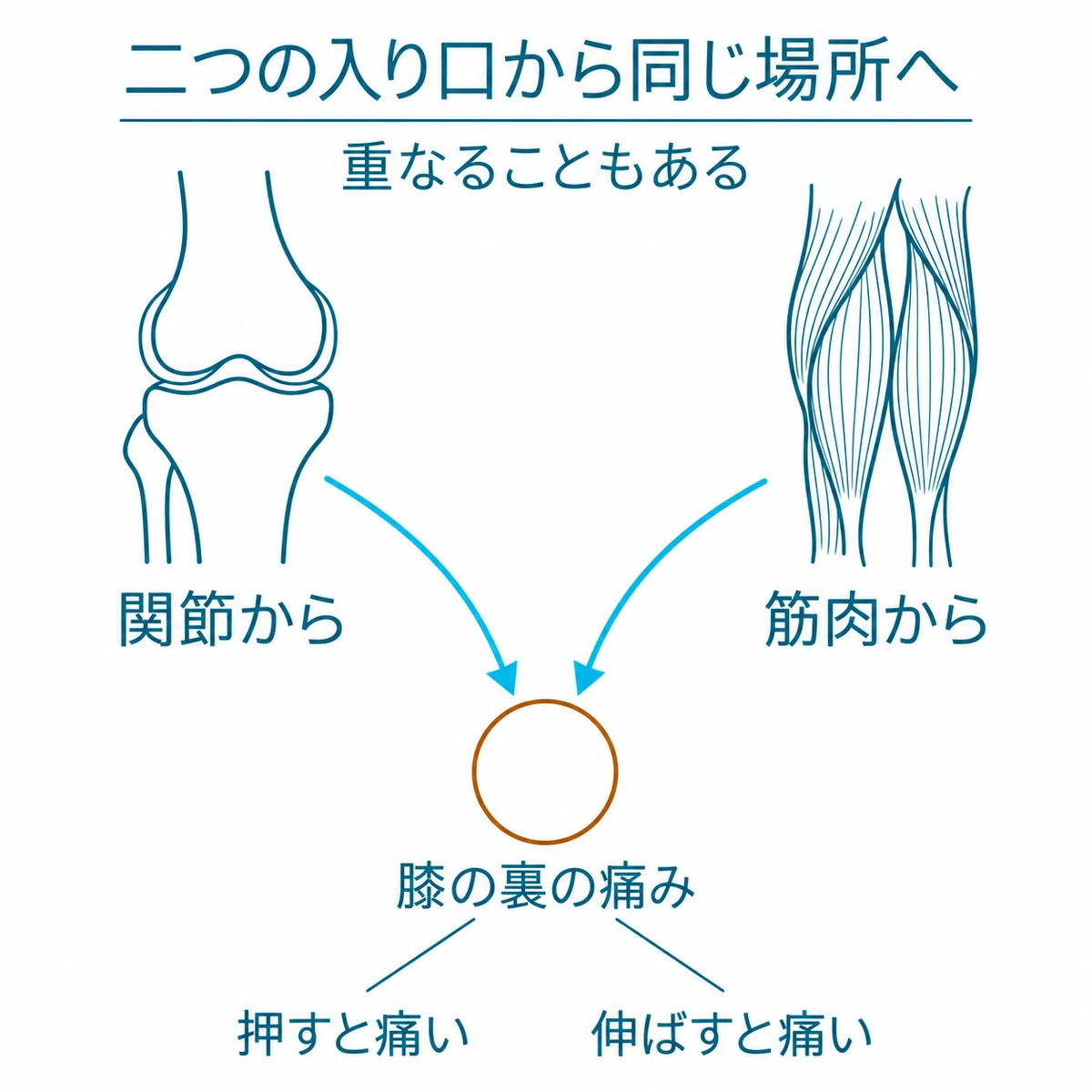 関節と筋肉から来る痛みが膝の裏で合流し、押したときや伸ばしたときに現れる様子