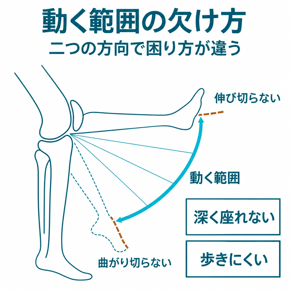 膝の曲げ伸ばしで届かない両端と、深く座れない・歩きにくい困りごとを示した可動域の図