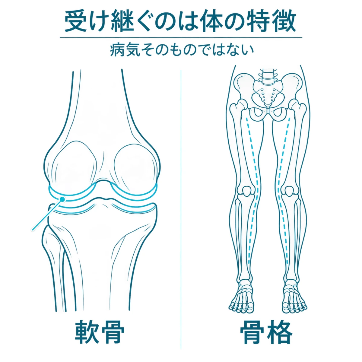 受け継がれる体の特徴として、膝の軟骨とO脚傾向の骨格を対比した図