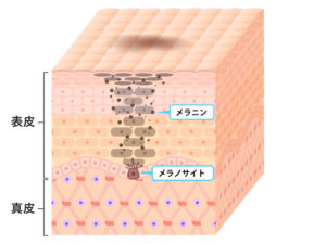 メラニン・メラノサイト