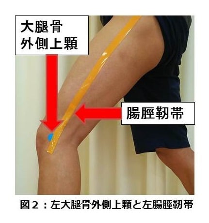 左大腿骨外側上顆と左腸脛靭帯