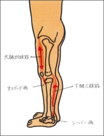 図１　代表的成長障害