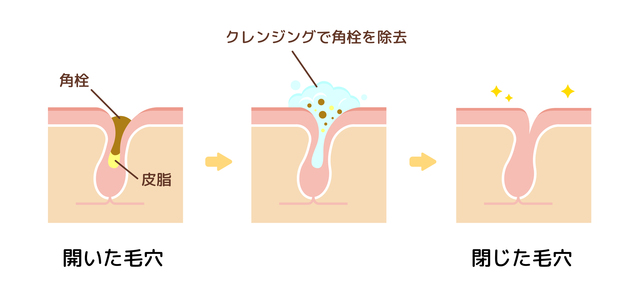 クレンジングで角栓を除去